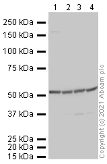 Western blot - Anti-beta Tubulin antibody - Loading Control (AB6046)