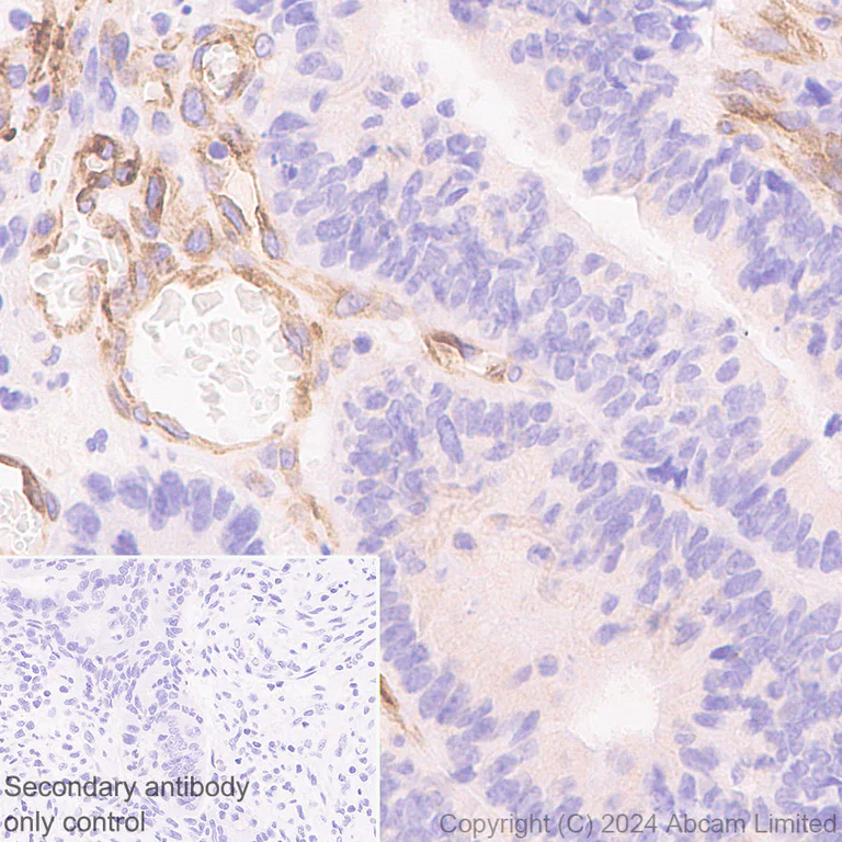 Immunohistochemistry (Formalin/PFA-fixed paraffin-embedded sections) - Anti-beta V Tubulin antibody [AA17] (AB322871)