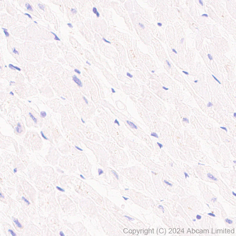 Immunohistochemistry (Formalin/PFA-fixed paraffin-embedded sections) - Anti-beta V Tubulin antibody [AA17] - BSA and Azide free (AB324805)