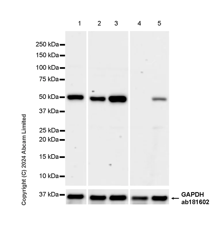 Western blot - Anti-beta V Tubulin antibody [AA17] - BSA and Azide free (AB324805)