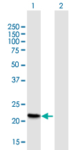 Western blot - Anti-Betatrophin antibody (AB168167), expandable thumbnail