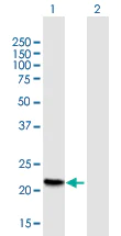Western blot - Anti-Betatrophin antibody (AB168167)