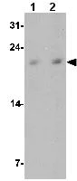 Western blot - Anti-Betatrophin antibody - N-terminal (AB180915)