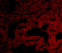 Immunocytochemistry - Anti-BFL-1/GRS antibody (AB45413)