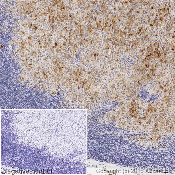 Immunohistochemistry (Formalin/PFA-fixed paraffin-embedded sections) - Anti-BFL-1/GRS antibody [SP435] (AB246319)