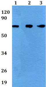 Western blot - Anti-BGT-1 antibody (AB200676), expandable thumbnail