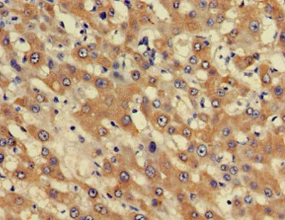 Immunohistochemistry (Formalin/PFA-fixed paraffin-embedded sections) - Anti-BHC80 / PHF21A antibody (AB224612)