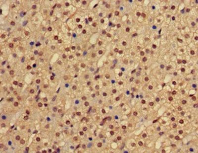 Immunohistochemistry (Formalin/PFA-fixed paraffin-embedded sections) - Anti-BHC80 / PHF21A antibody (AB224612)