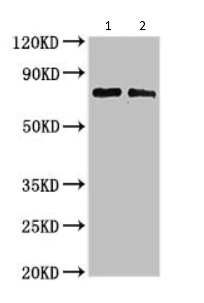 Western blot - Anti-BHC80 / PHF21A antibody (AB224612)