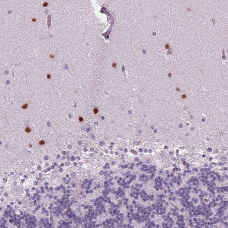 Immunohistochemistry (Formalin/PFA-fixed paraffin-embedded sections) - Anti-BHLHB5 antibody (AB204791)