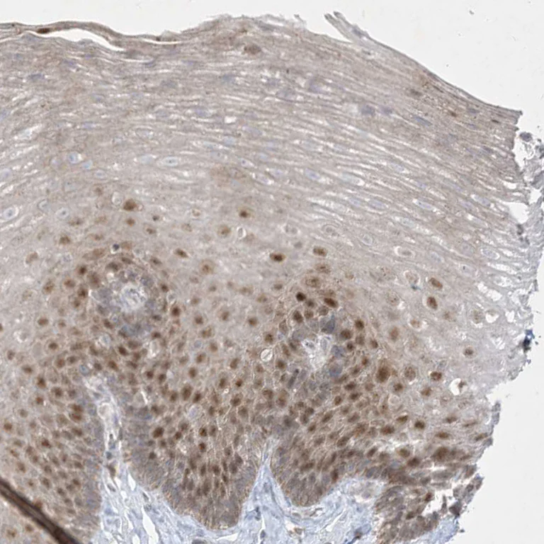 Immunohistochemistry (Formalin/PFA-fixed paraffin-embedded sections) - Anti-BHLHE40 Antibody (AB327215)