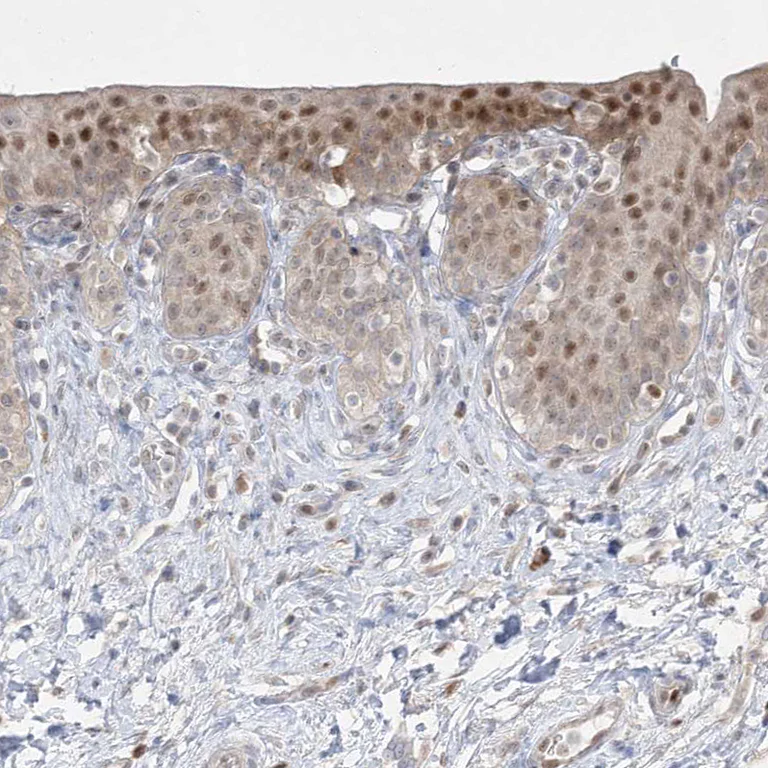 Immunohistochemistry (Formalin/PFA-fixed paraffin-embedded sections) - Anti-BHLHE40 Antibody (AB327215)