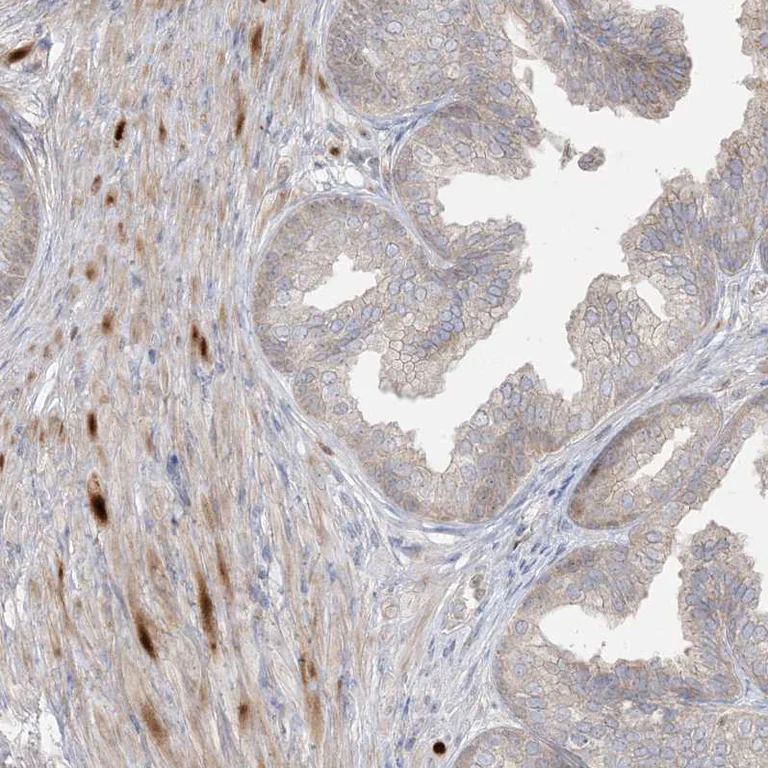Immunohistochemistry (Formalin/PFA-fixed paraffin-embedded sections) - Anti-BHLHE40 Antibody (AB327215)