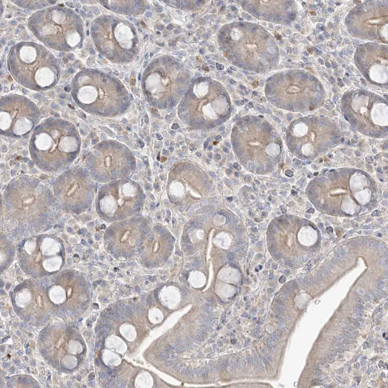 Immunohistochemistry (Formalin/PFA-fixed paraffin-embedded sections) - Anti-BHLHE40 Antibody (AB327215)
