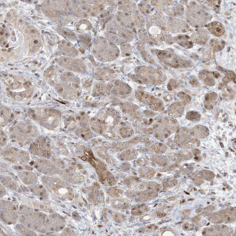 Immunohistochemistry (Formalin/PFA-fixed paraffin-embedded sections) - Anti-BHLHE40 Antibody (AB327215)