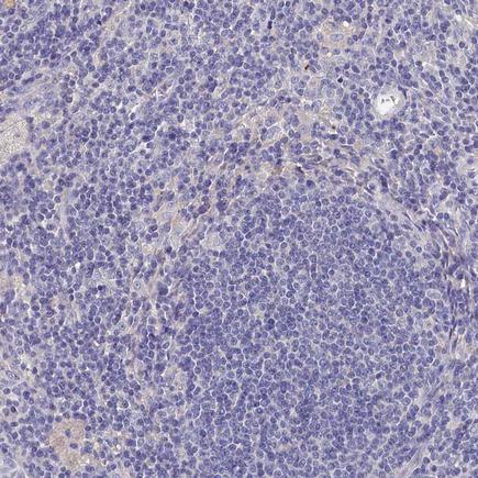 Immunohistochemistry (Formalin/PFA-fixed paraffin-embedded sections) - Anti-BHMT antibody (AB243698)