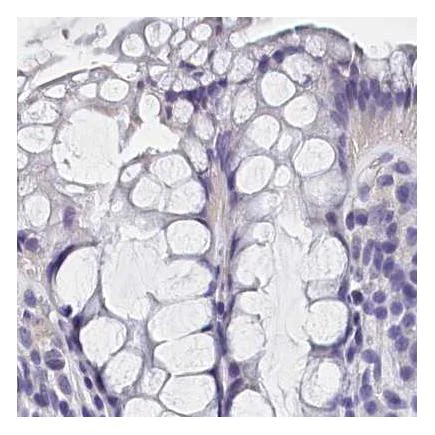 Immunohistochemistry (Formalin/PFA-fixed paraffin-embedded sections) - Anti-BHMT antibody (AB243698)
