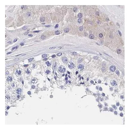 Immunohistochemistry (Formalin/PFA-fixed paraffin-embedded sections) - Anti-BHMT antibody (AB243698)