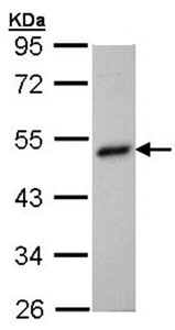 Western blot - Anti-BHMT antibody (AB96415), expandable thumbnail