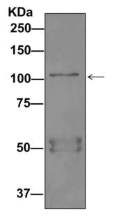 Immunoprecipitation - Anti-BICD1 antibody [EPR11642] - BSA and Azide free (AB249558)