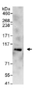 Immunoprecipitation - Anti-BICD2 antibody (AB117818)