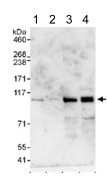 Western blot - Anti-BICD2 antibody (AB117818)