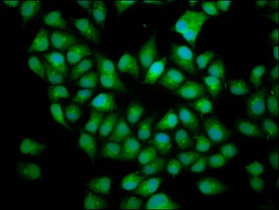 Immunocytochemistry/ Immunofluorescence - Anti-BICD2 antibody (AB237616)