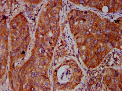 Immunohistochemistry (Formalin/PFA-fixed paraffin-embedded sections) - Anti-BICD2 antibody (AB237616)