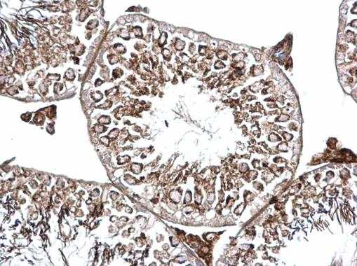 Immunohistochemistry (Formalin/PFA-fixed paraffin-embedded sections) - Anti-BICD2 antibody - C-terminal (AB229230)