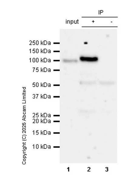 Immunoprecipitation - Anti-BICD2 antibody [EPR30244-565] (AB325398)