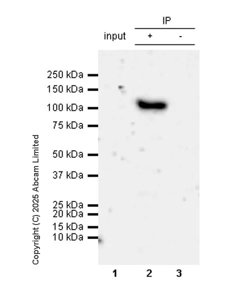 Immunoprecipitation - Anti-BICD2 antibody [EPR30244-565] (AB325398)