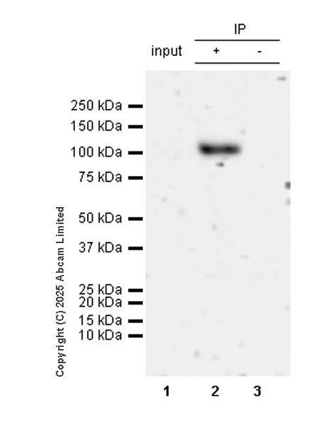 Immunoprecipitation - Anti-BICD2 antibody [EPR30244-565] (AB325398)