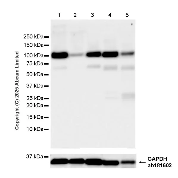 Western blot - Anti-BICD2 antibody [EPR30244-565] (AB325398)