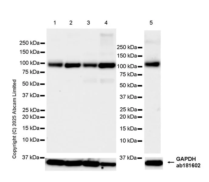 Western blot - Anti-BICD2 antibody [EPR30244-565] (AB325398)