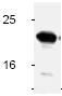 Western blot - Anti-Bid antibody (AB2388)