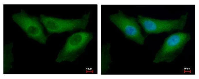 Immunocytochemistry/ Immunofluorescence - Anti-Bid antibody (AB272880)