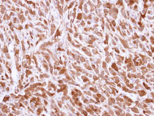 Immunohistochemistry (Formalin/PFA-fixed paraffin-embedded sections) - Anti-Bid antibody (AB272880)