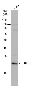 Western blot - Anti-Bid antibody (AB272880)
