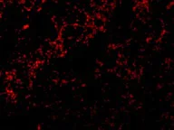 Immunocytochemistry/ Immunofluorescence - Anti-Bid antibody (AB62469)