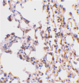 Immunohistochemistry (Formalin/PFA-fixed paraffin-embedded sections) - Anti-Bid antibody (AB62469)