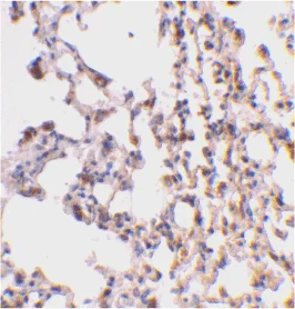 Immunohistochemistry (Formalin/PFA-fixed paraffin-embedded sections) - Anti-Bid antibody (AB62469)