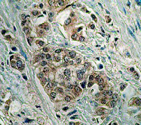 Anti-Bid antibody [Y8]
