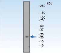 Western blot - Anti-Bid antibody [Y8] (AB32060)
