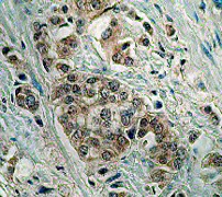Immunohistochemistry (Formalin/PFA-fixed paraffin-embedded sections) - Anti-Bid antibody [Y8] - BSA and Azide free (AB247217)