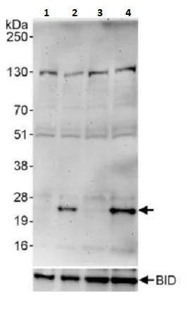 Western blot - Anti-BID (phospho S78) antibody (AB264131)