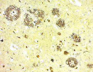 Immunohistochemistry (Formalin/PFA-fixed paraffin-embedded sections) - Bielschowsky Silver Stain Kit (AB245877)