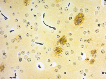 Immunohistochemistry (Formalin/PFA-fixed paraffin-embedded sections) - Bielschowsky Silver Stain Kit (AB245877)