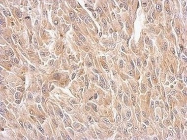 Immunohistochemistry (Formalin/PFA-fixed paraffin-embedded sections) - Anti-Bif-1 antibody (AB154236), expandable thumbnail