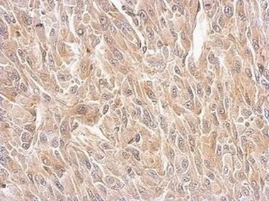 Immunohistochemistry (Formalin/PFA-fixed paraffin-embedded sections) - Anti-Bif-1 antibody (AB154236)