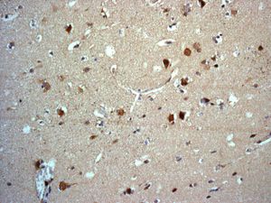 Immunohistochemistry (Formalin/PFA-fixed paraffin-embedded sections) - Anti-BIG-2 antibody [EPR8736] (AB131285), expandable thumbnail